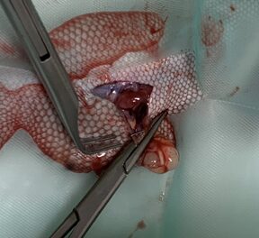 Caso clínico Geco: Detalle de colocación de un hemoclip en el pedículo de un ovario de un geco con un ovario nornmal sin folículos preovulatorios.