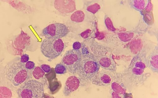 Caso clínico endoscopia aves: imagen de citología