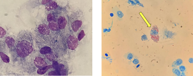 Caso clínico endoscopia aves: imagen de citología