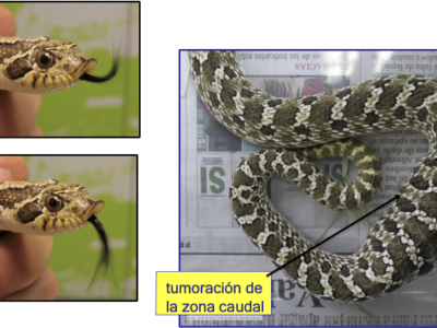 Cas clínic de cirurgia en serp per tumor renal