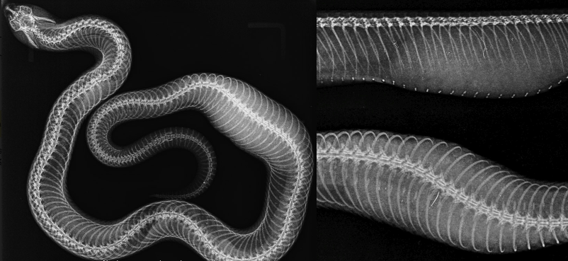 Fig 2. Caso clínico serpiente: métodos complementarios de exploración: ecografía y RX