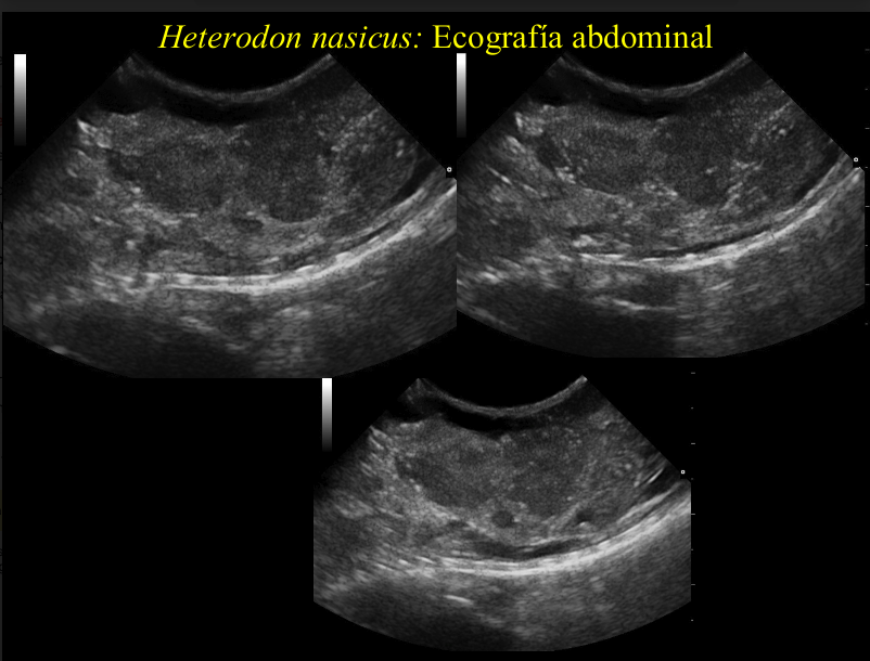 Fig 3. Caso clínico serpiente: ecografía abdominal