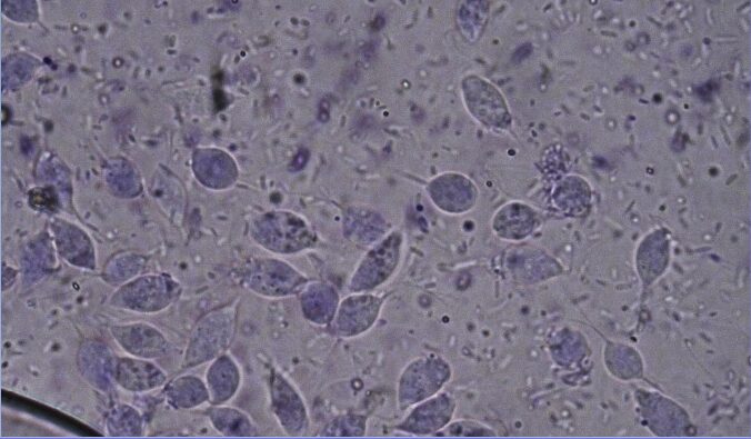Caso clínico serpiente: masa abdominal en Heterodon nasicus: Fig. 1 Examen heces: presencia de gran cantidad de tricomonas en las heces sanguinolentas